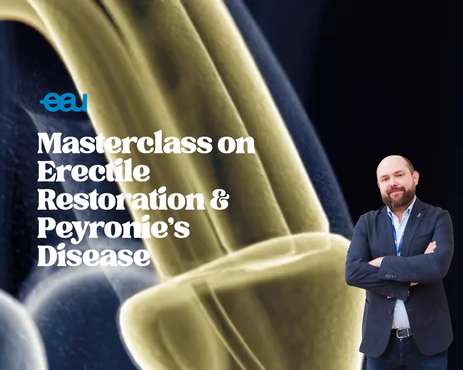 Masterclass de l'EAU sur la restauration de la fonction érectile et la maladie de Peyronie